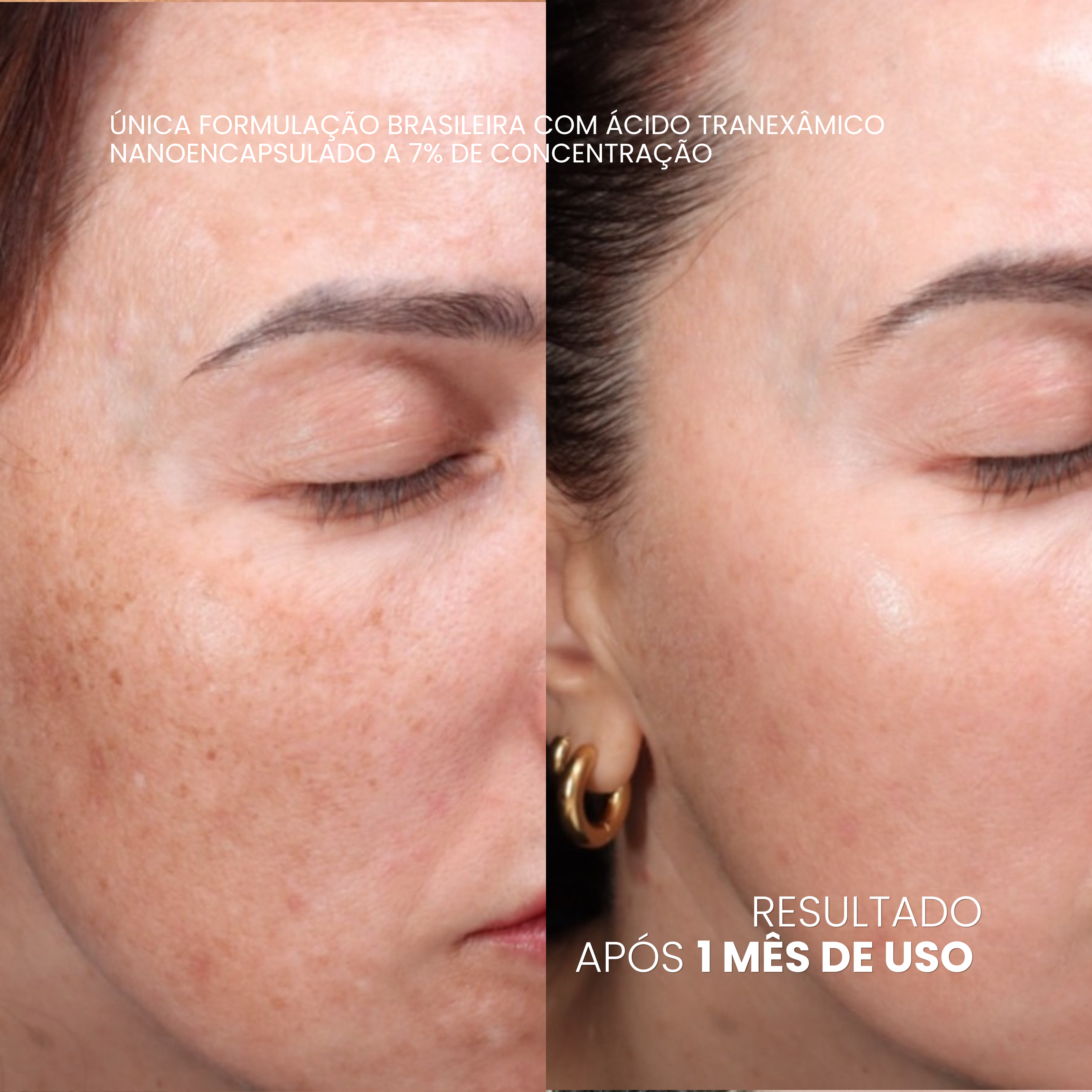 VISAGE D'OR — Sérum Clareador de Manchas & Melasma