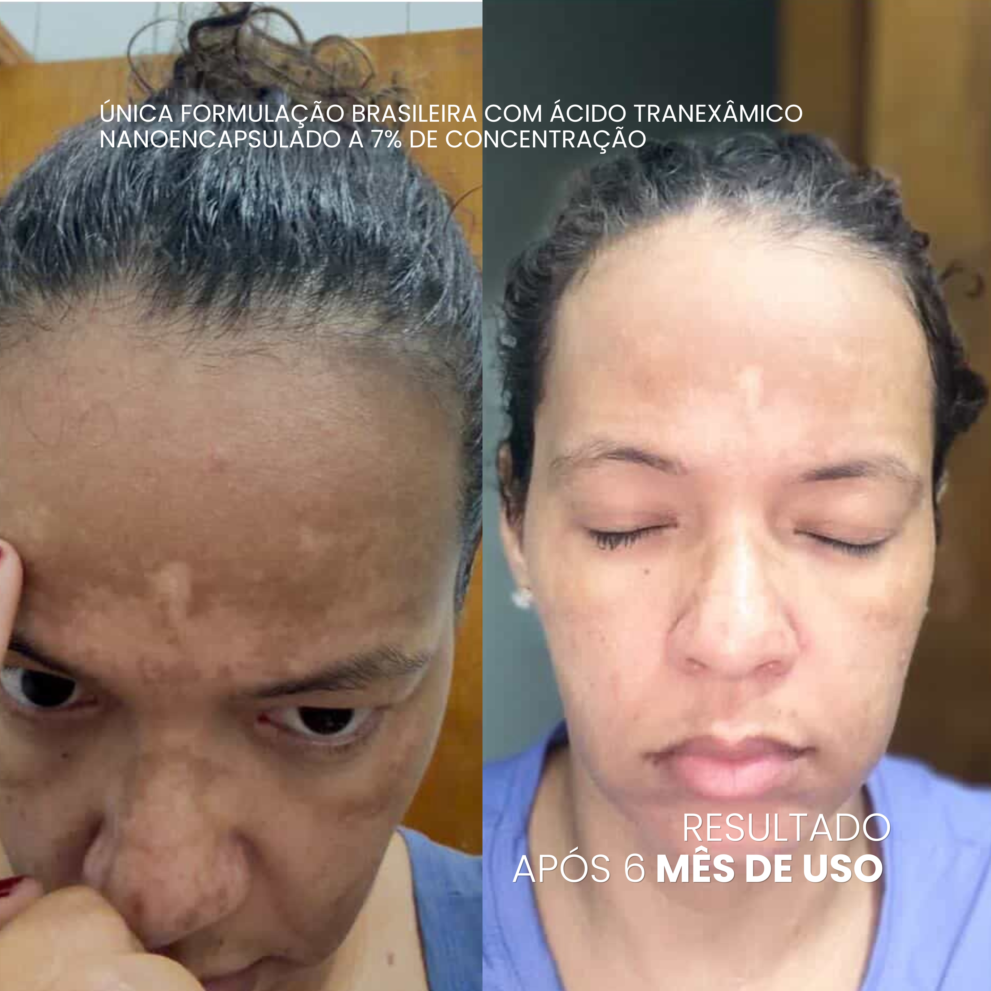 VISAGE D'OR — Sérum Clareador de Manchas & Melasma
