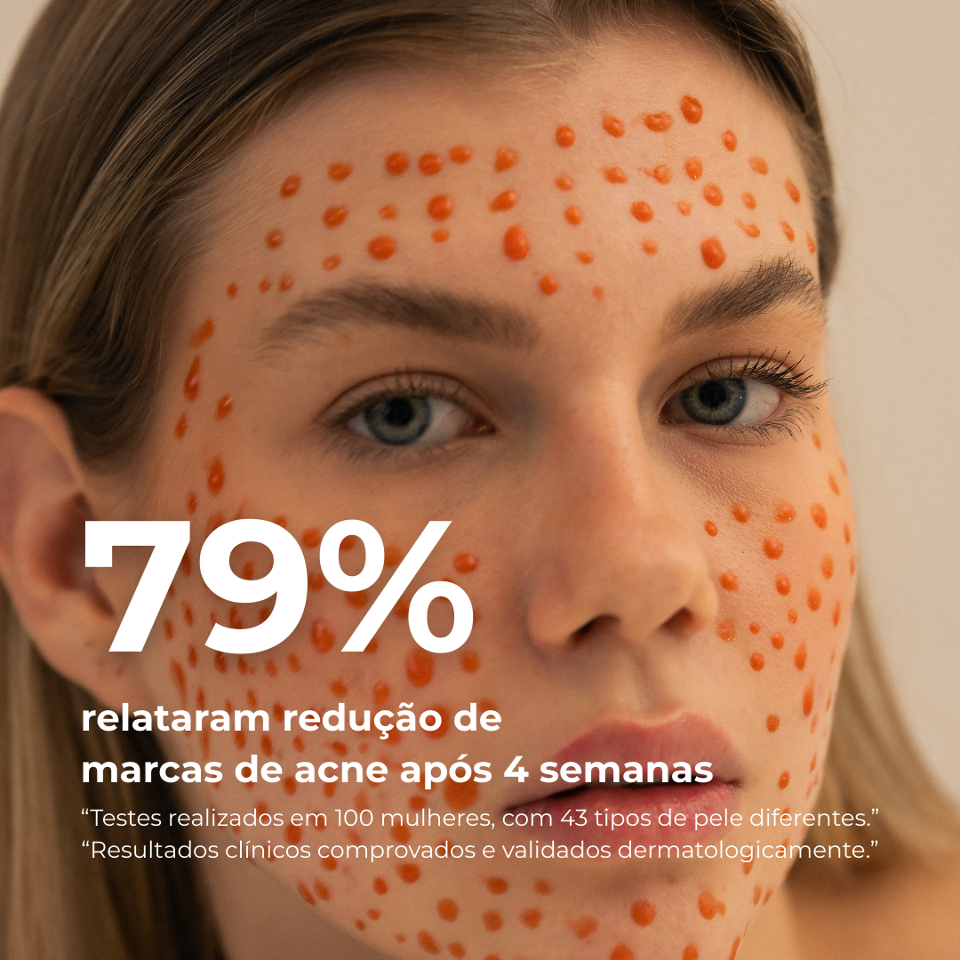 PICOTAGE – Peeling com Microspículas