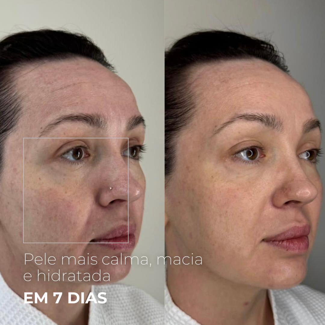 EXOMAGE – Booster de PDRN com Exossomos