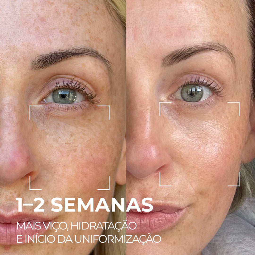 VISAGE D’OR – Sérum Clareador com TXA