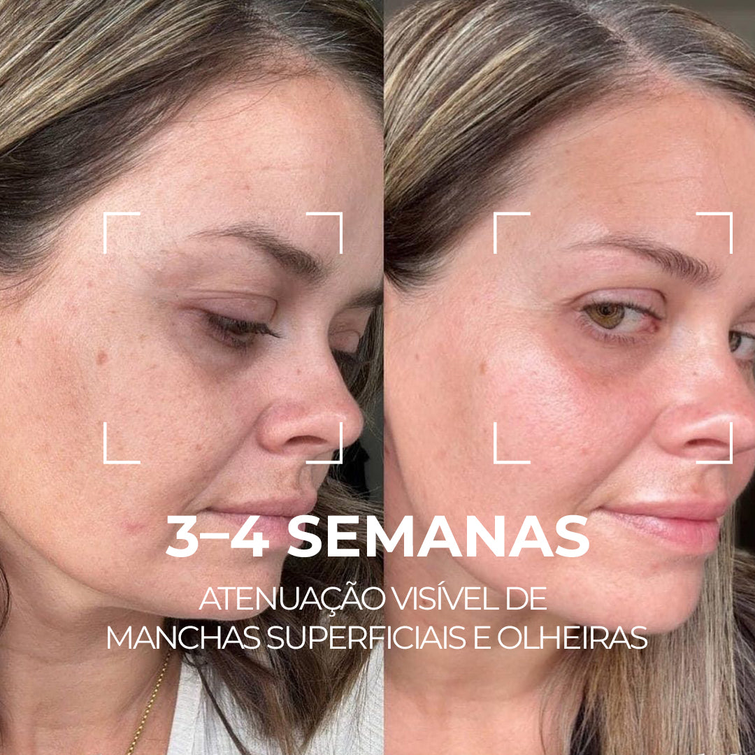 VISAGE D’OR – Sérum Clareador com TXA