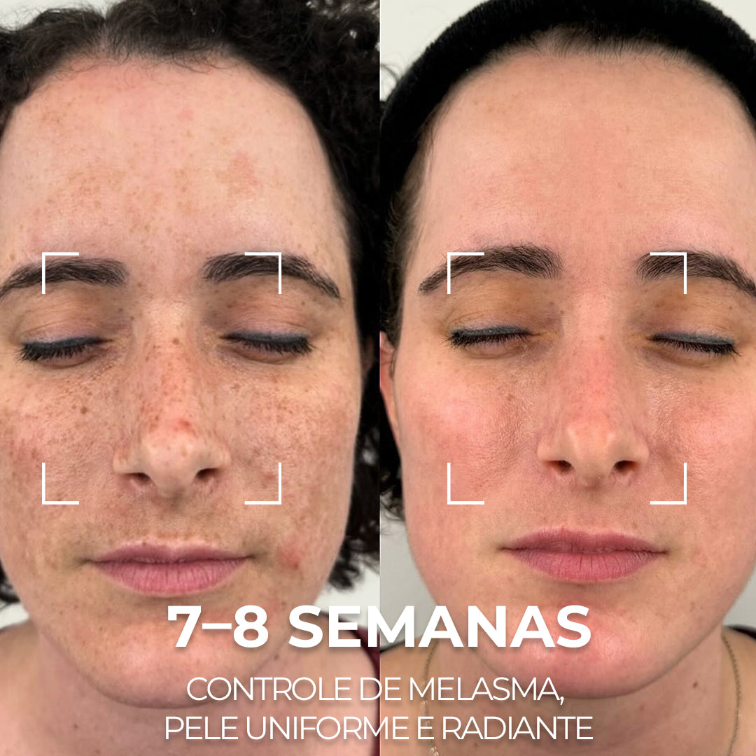 VISAGE D’OR – Sérum Clareador com TXA