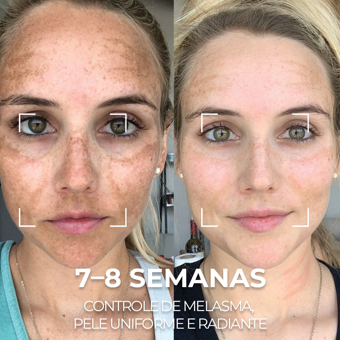 VISAGE D’OR – Sérum Clareador com TXA