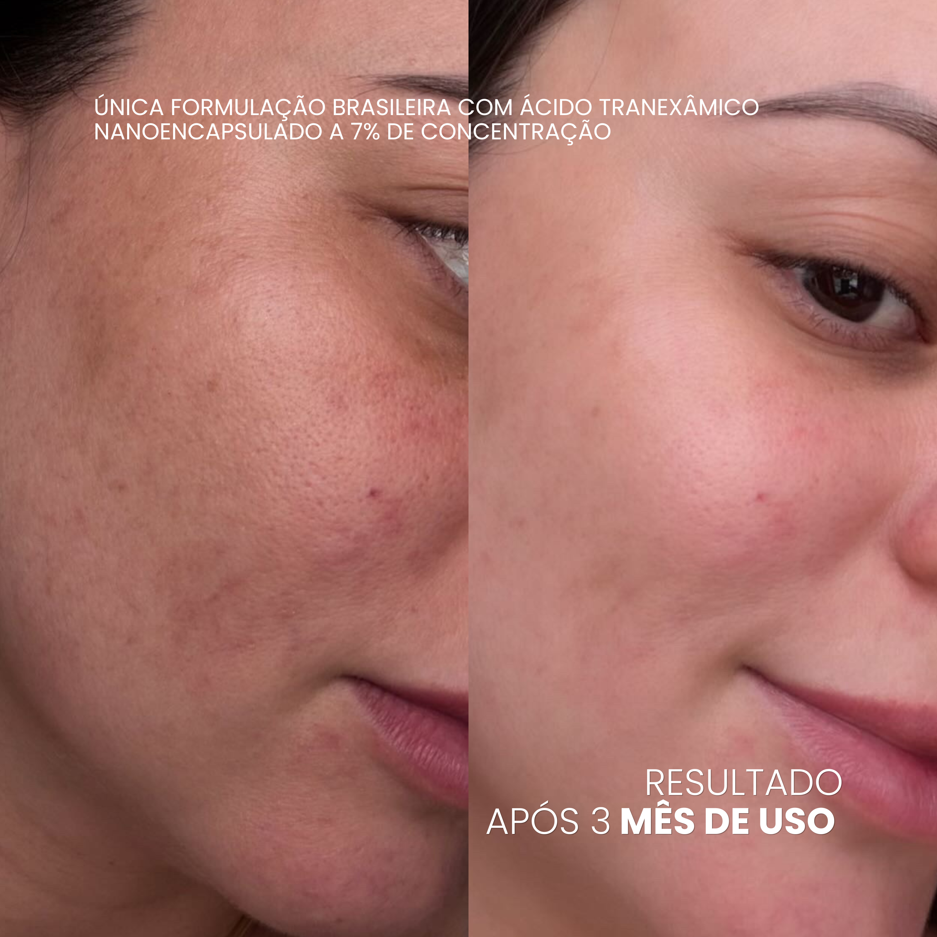 VISAGE D'OR — Sérum Clareador de Manchas & Melasma