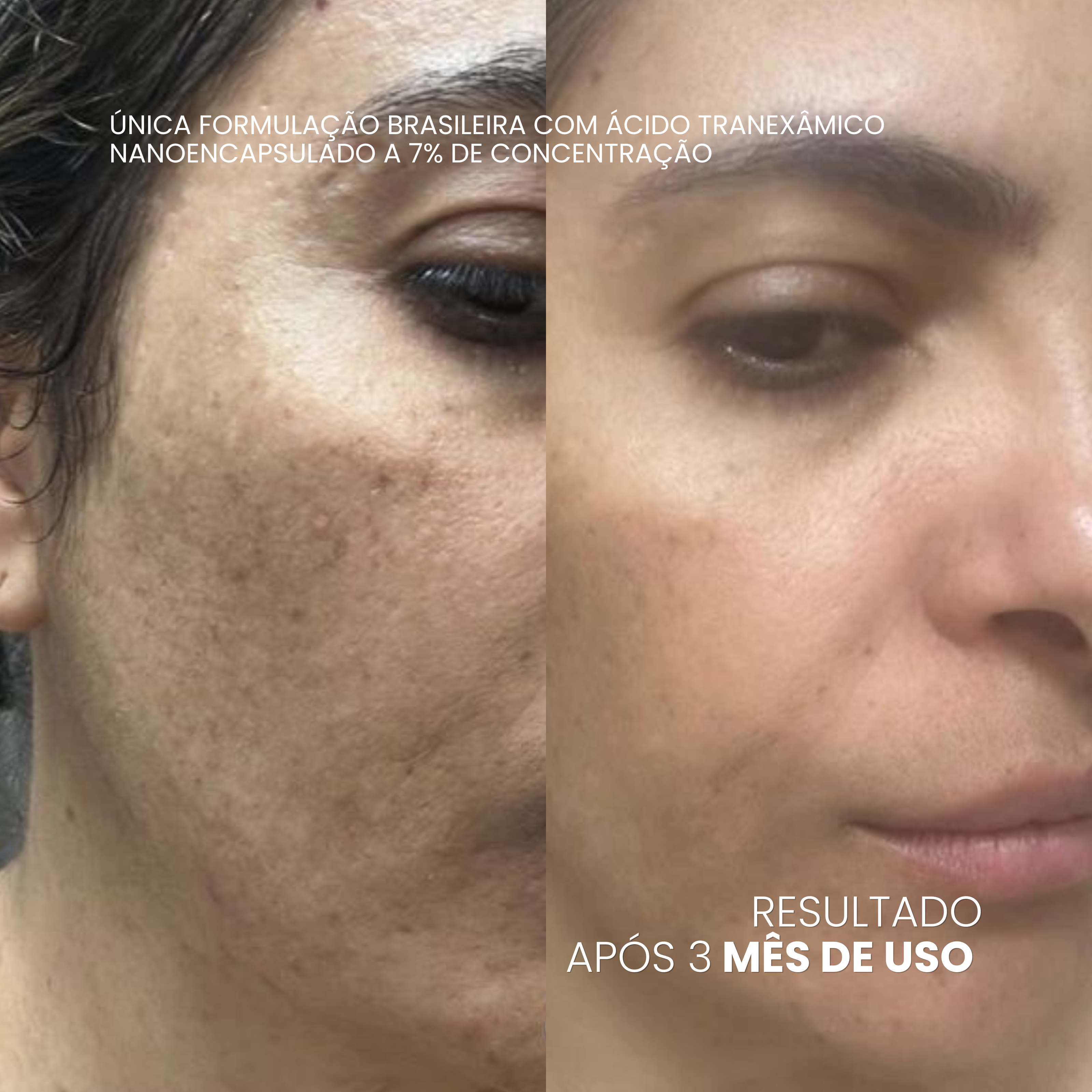 VISAGE D'OR — Sérum Clareador de Manchas & Melasma