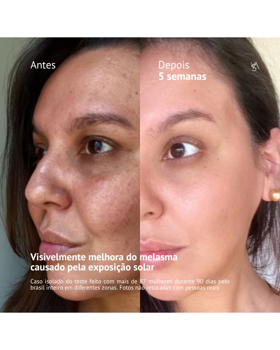 Visage D'or - Sérum Clareador com Tecnologia BioSync³TM