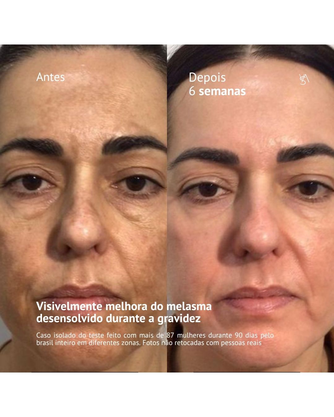 Visage D'or - Sérum Clareador com Tecnologia BioSync³TM