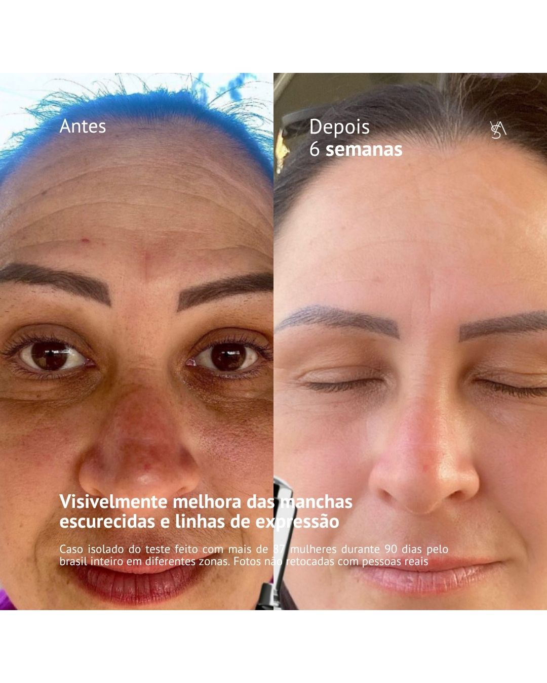 Visage D'or - Sérum Clareador com Tecnologia BioSync³TM