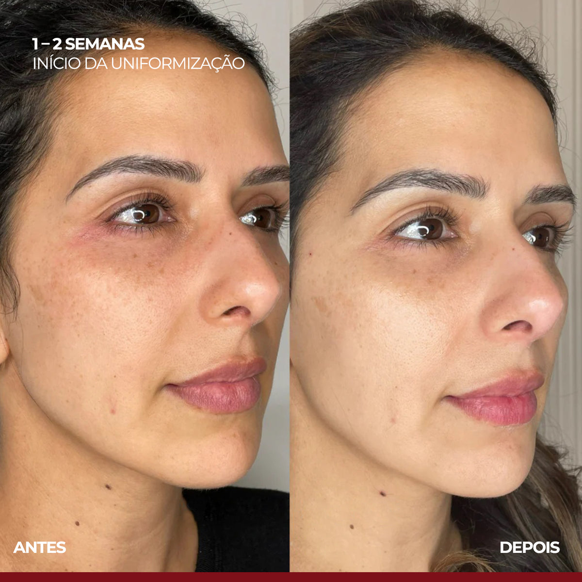 VISAGE D'OR - Sérum Clareador de Manchas & Melasma