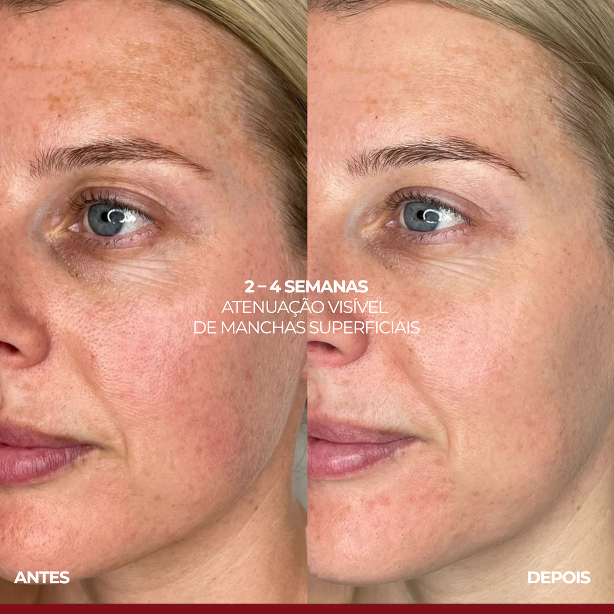 VISAGE D'OR - Sérum Clareador de Manchas & Melasma