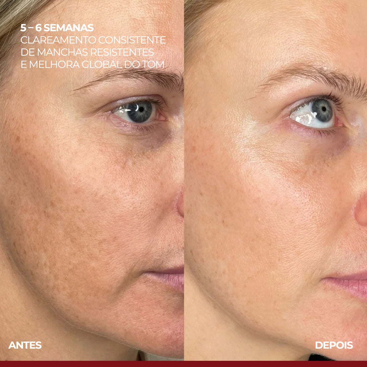 VISAGE D'OR - Sérum Clareador de Manchas & Melasma