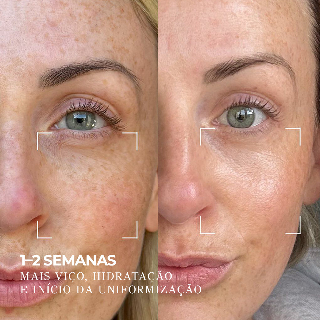 VISAGE D’OR – Sérum Clareador com 7% de TXA