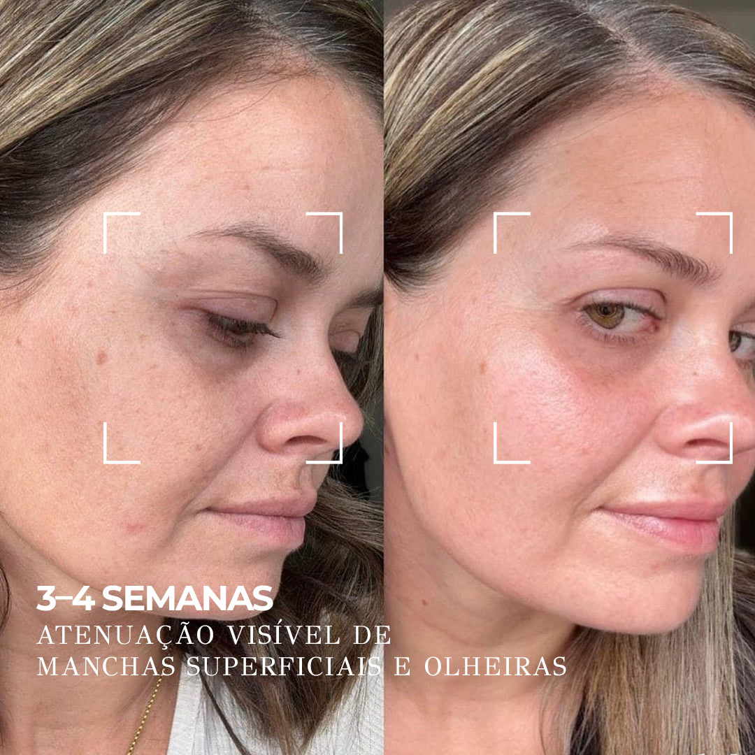 VISAGE D’OR – Sérum Clareador com 7% de TXA