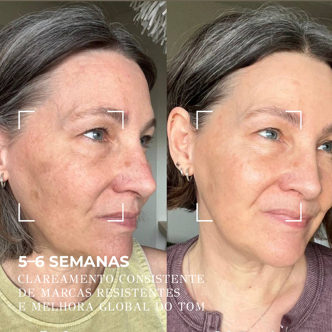 VISAGE D’OR – Sérum Clareador com 7% de TXA