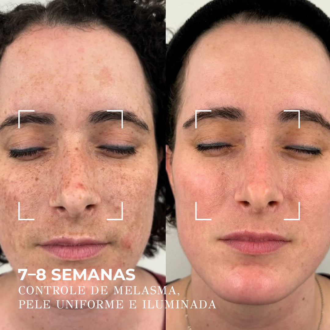 VISAGE D’OR – Sérum Clareador com 7% de TXA